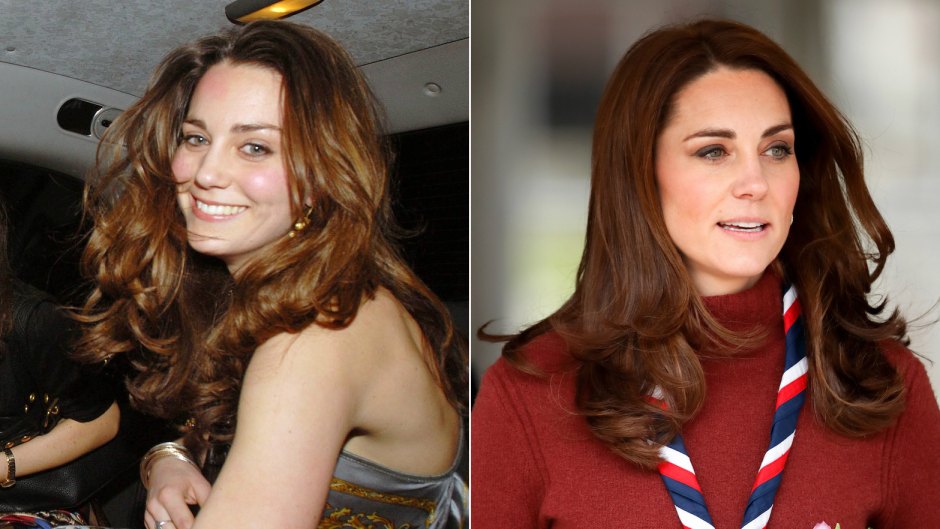kate middleton plastic surgery doctors think she gets botox