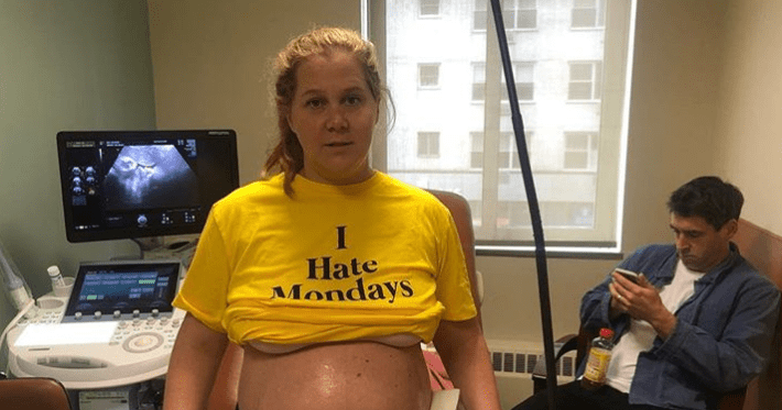 Amy Schumer Claps Back at Fans Who Think She’s Been Pregnant Too Long: ‘Imagine How I Feel!’