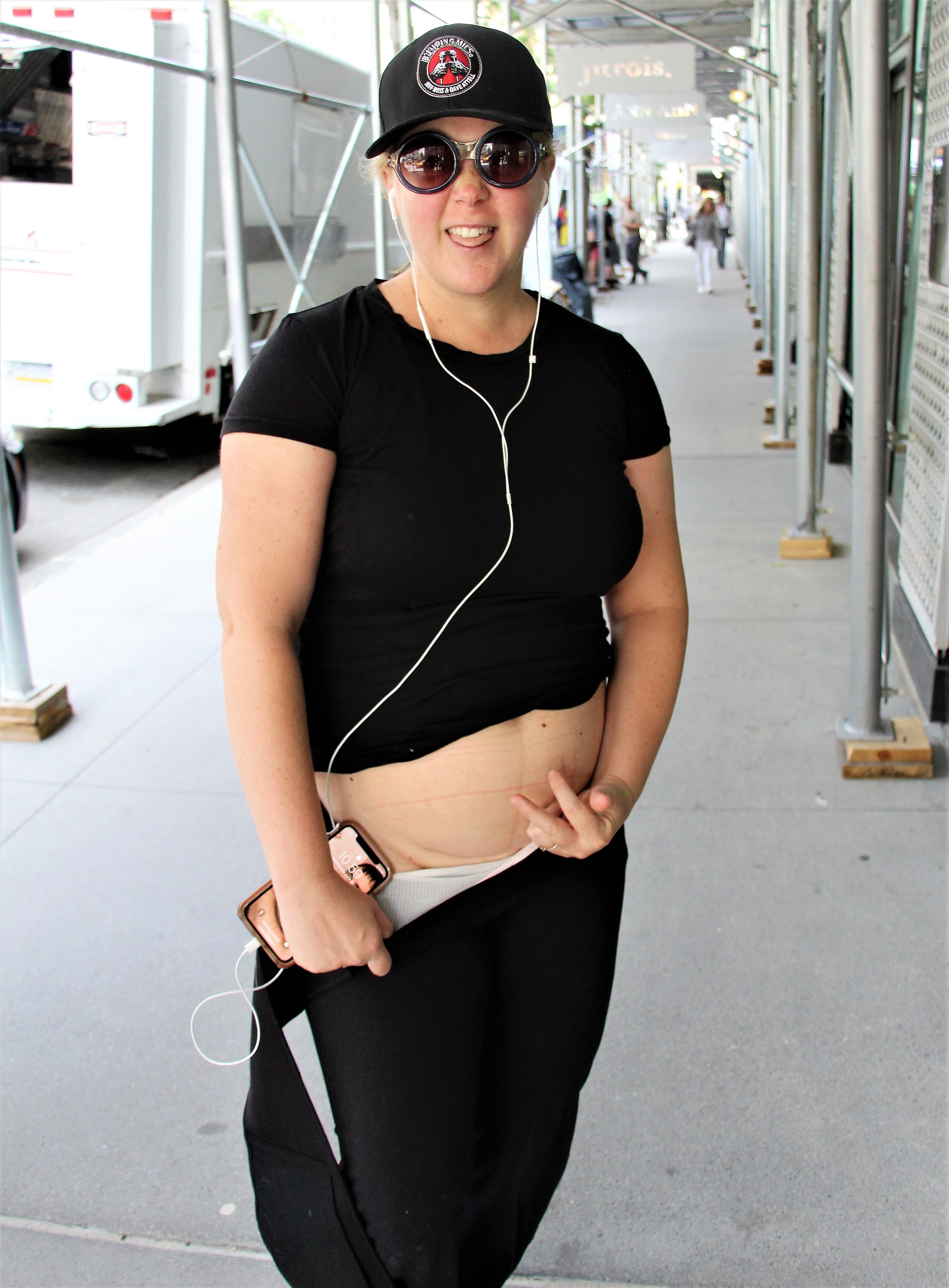 Amy Schumer Proudly Shows Off Her C-Section Scar in NYC