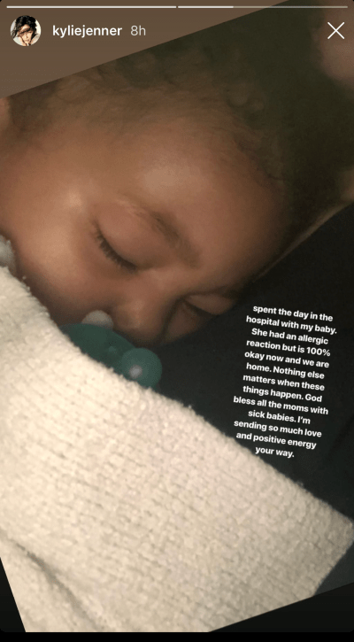 Kylie Jenner Stormi Webster allergic reaction allergy attack hospital
