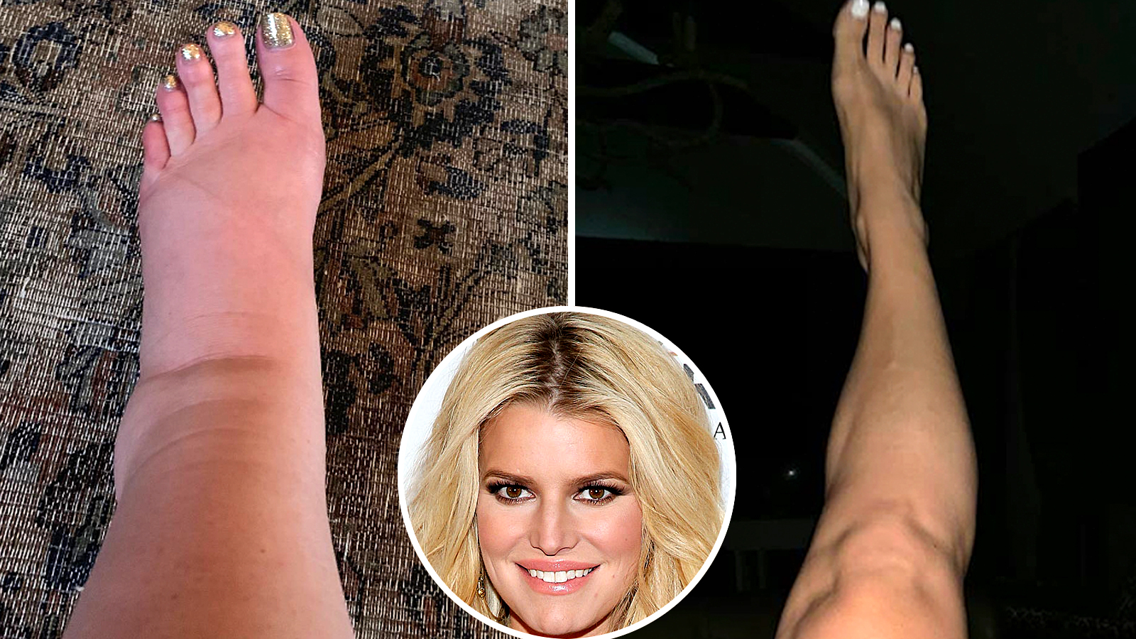 Jessica Simpson Flaunts Ankles 2 Months After Giving Birth Photo Jessica Simpson Flaunts Ankles 2 Months After Giving Birth Photo