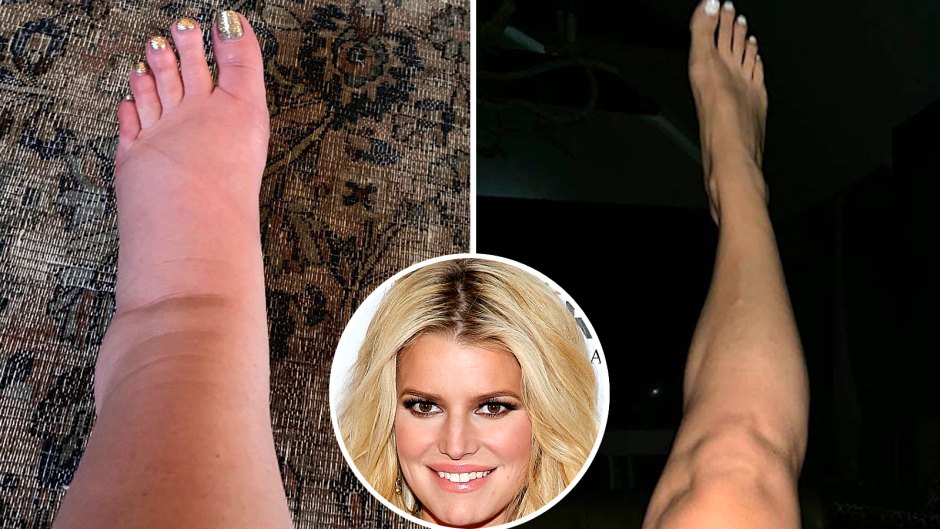 Jessica Simpson Flaunts Her Toned Ankles 2 Months After Giving Birth to Daughter Birdie