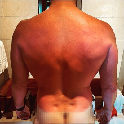 Chris Pratt's Sunburned Back and White Butt