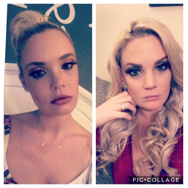 90 Day Fiance Ashley Martson Lip Injections Botox