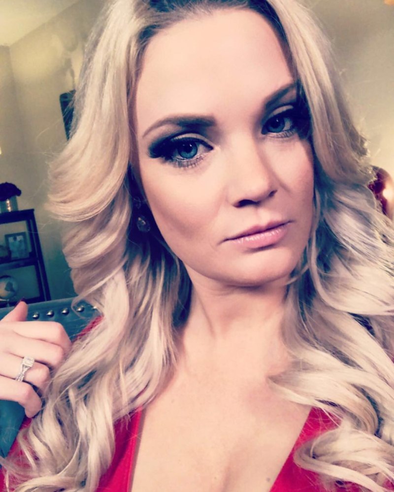 90 Day Fiance Ashley Martson Lip Injections Botox