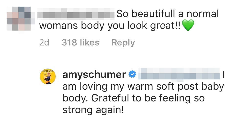 Amy Schumer