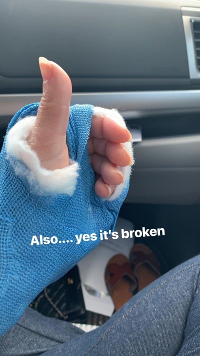 Carly Waddell broken finger