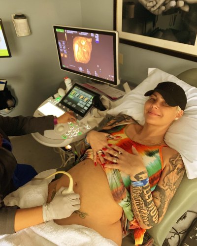 Amber Rose pregnant getting an ultrasound