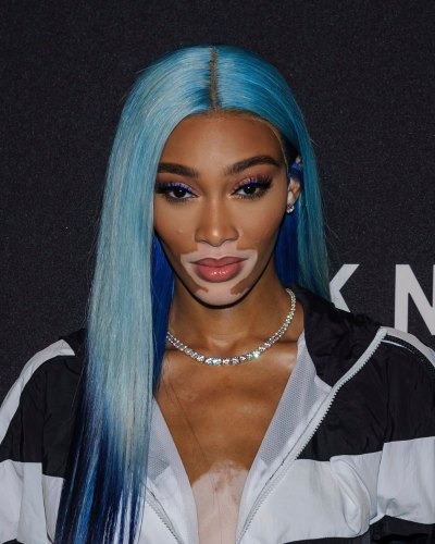 Winnie Harlow Blue Hair