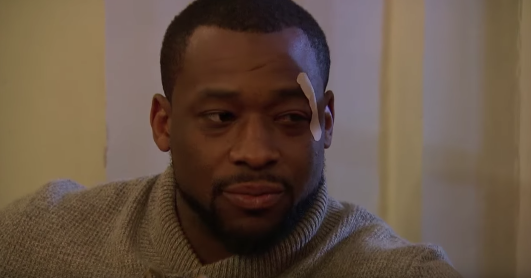 Kenny King Eye Gash The Bachelorette With Rachel Lindsay