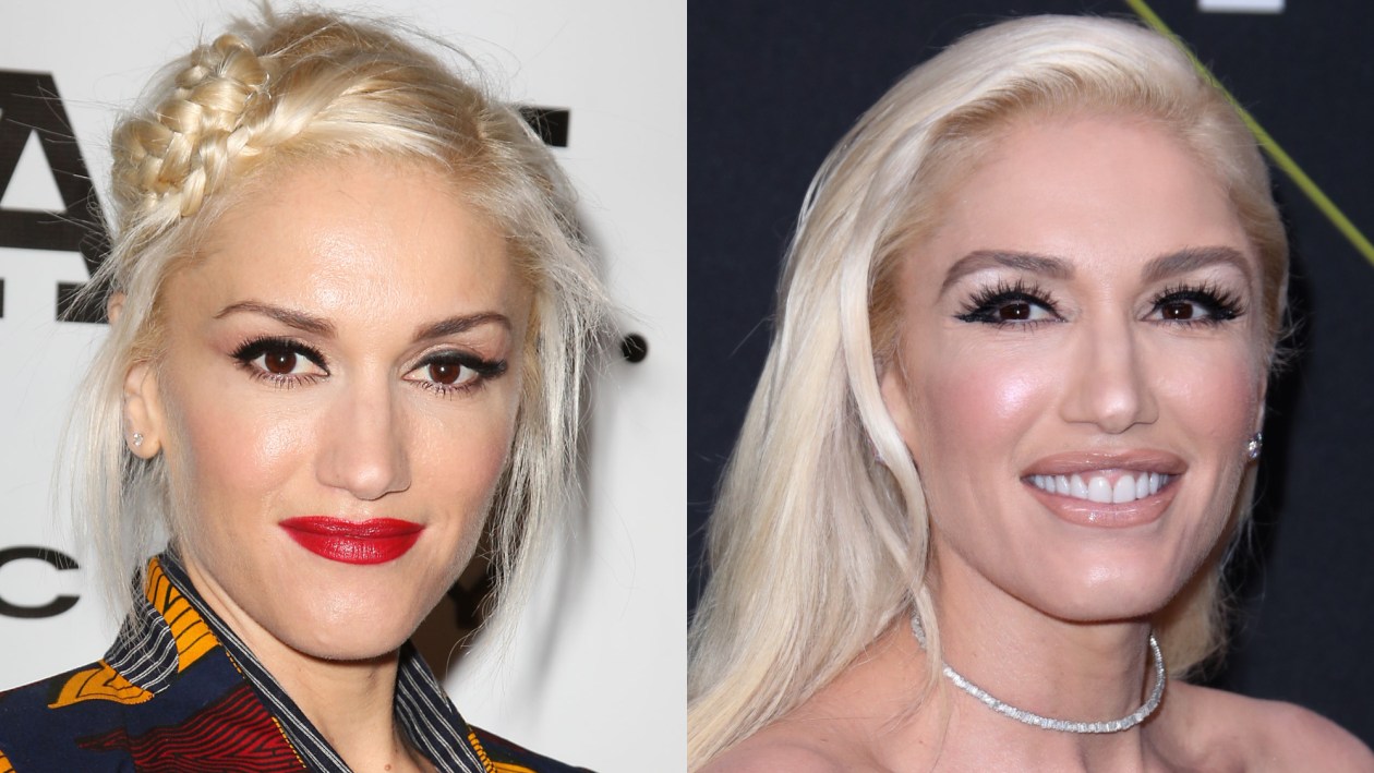 gwen stefani plastic surgery reddit Image 9