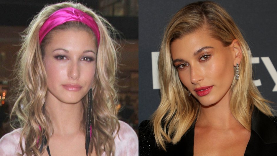 Always a Stunner! See Hailey Bieber's Transformation Over the Years