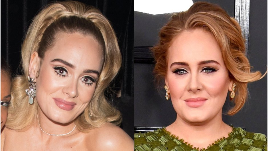 Adele nose job exclusive feature
