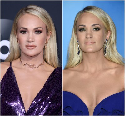 Carrie Underwood Face in 2017 vs 2019 After Fall