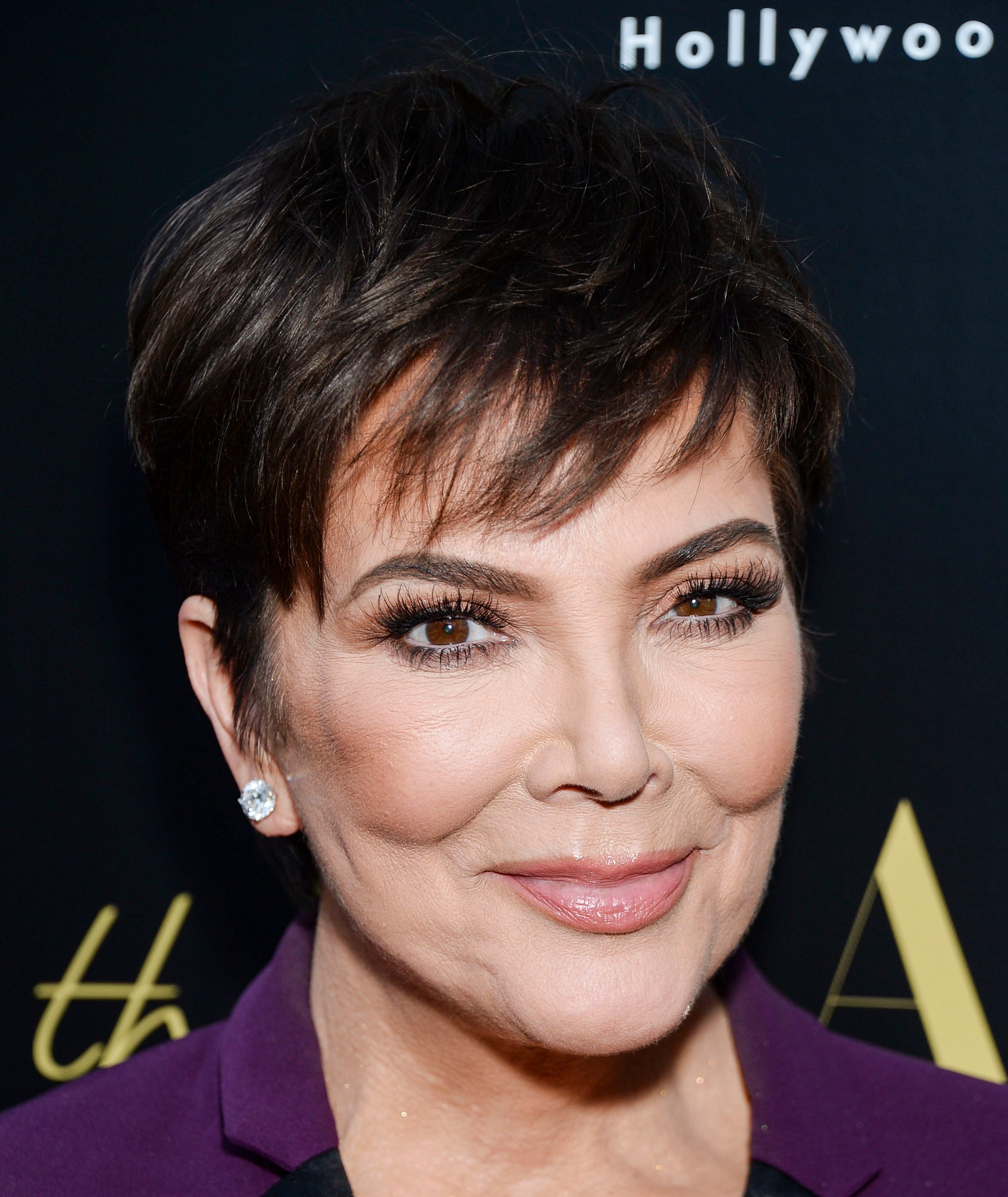 Kris Jenner Cheek Fillers