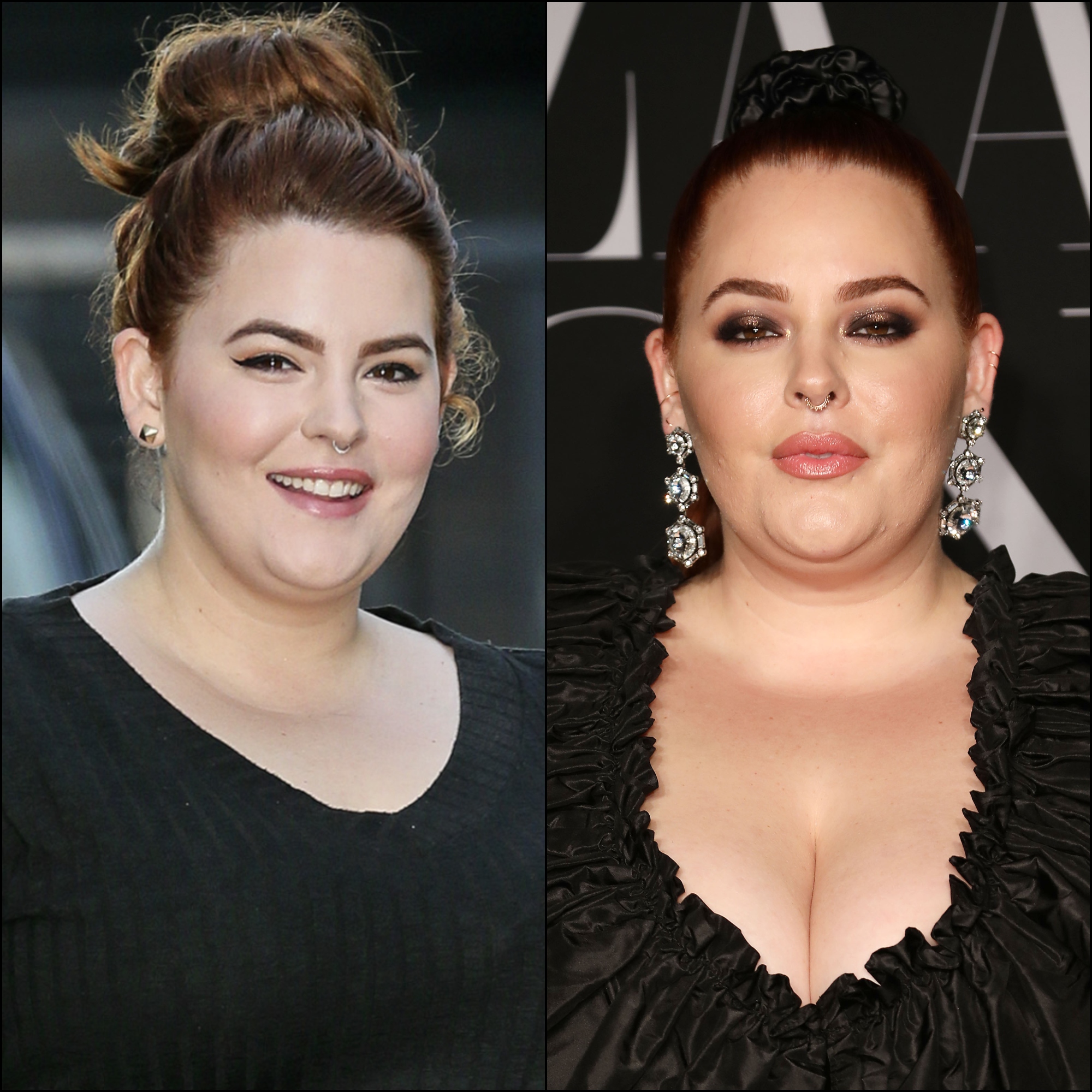 Tess Holliday Plastic Surgery: What Procedures Has the Model Done