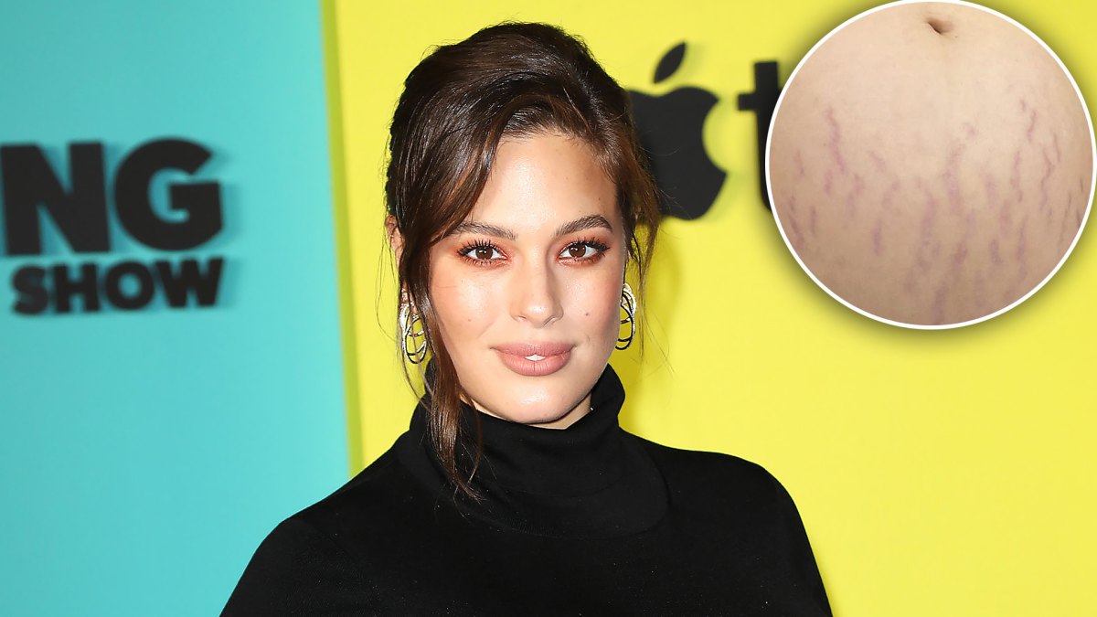 Ashley Graham stretch marks post baby body p