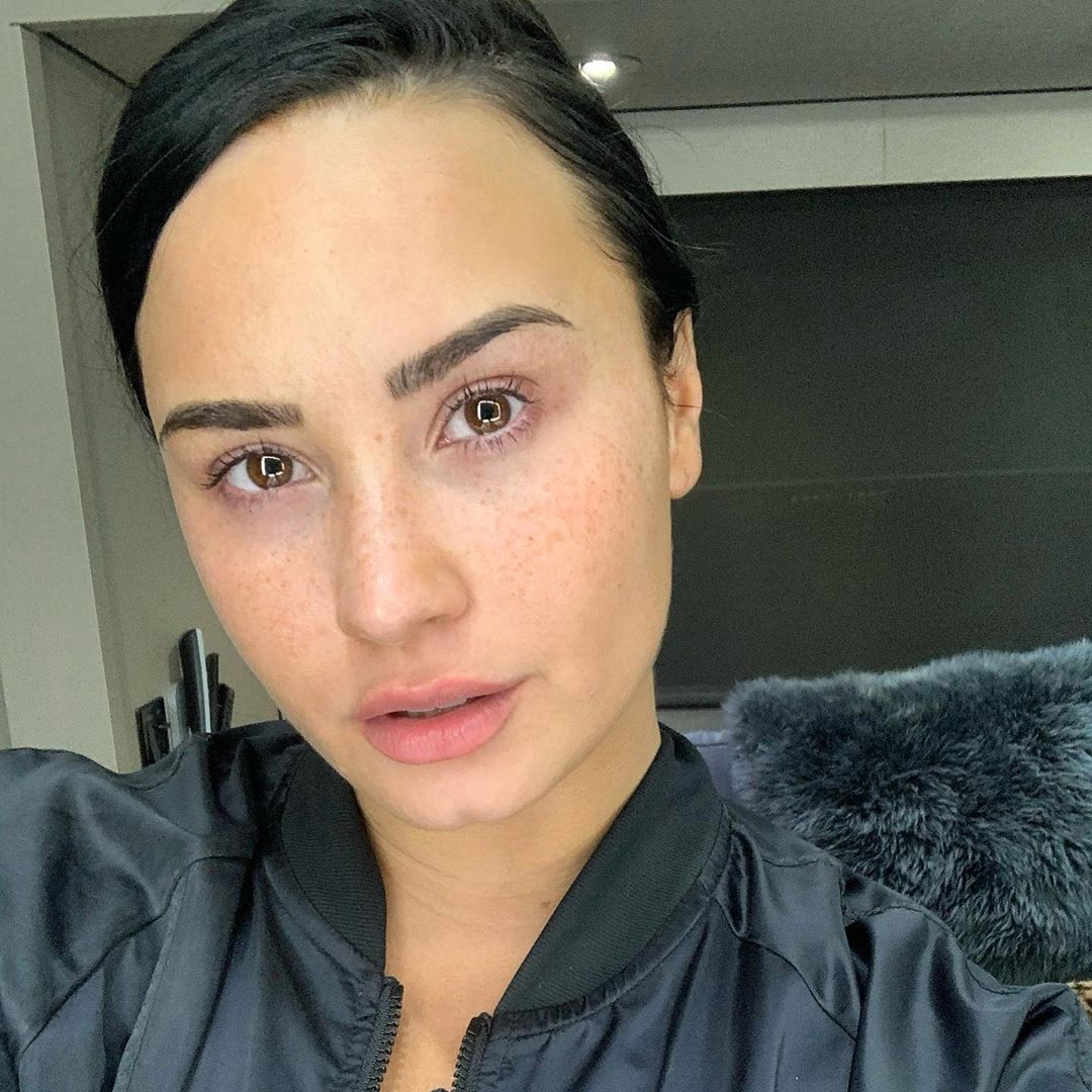 Demi Lovato Freckles