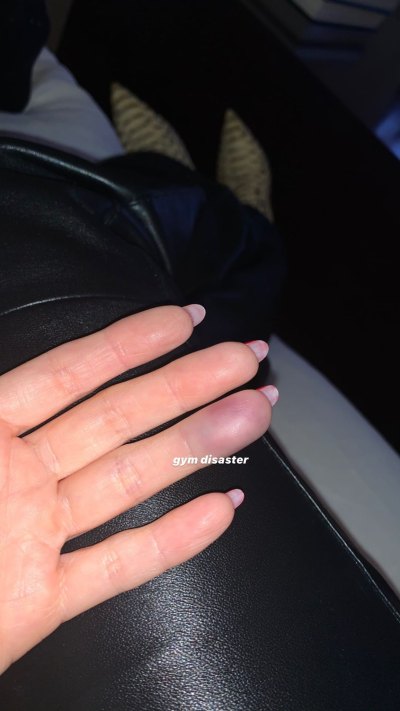 Kourtney Kardashian Black-and-Blue Finger from Gym Injury