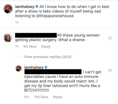 Halsey Says She Can't Get Fillers Because of Autoimmune Disease