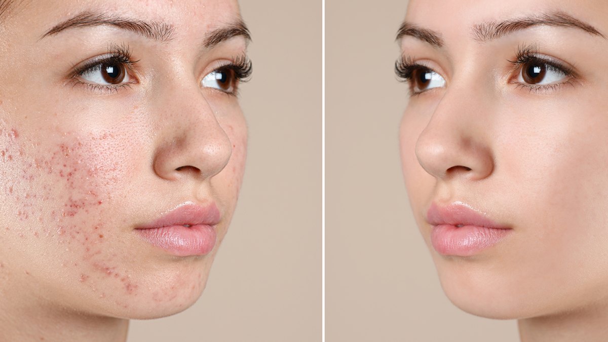 amazon-face-pads