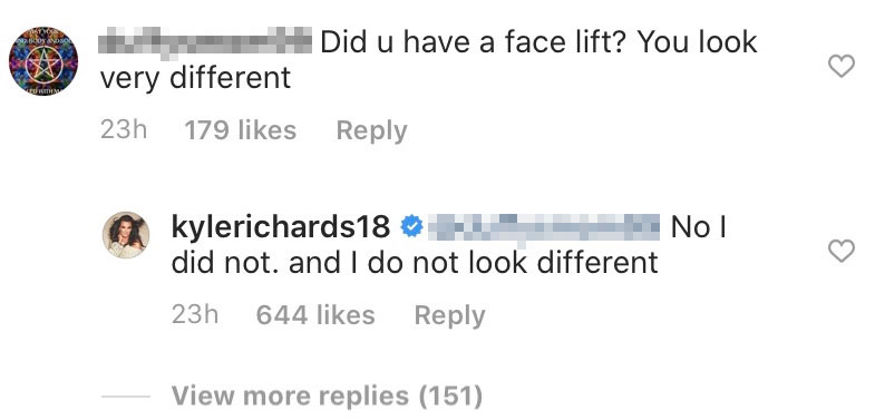 RHOBH Star Kyle Richards Claps Back at Facelift Accusations