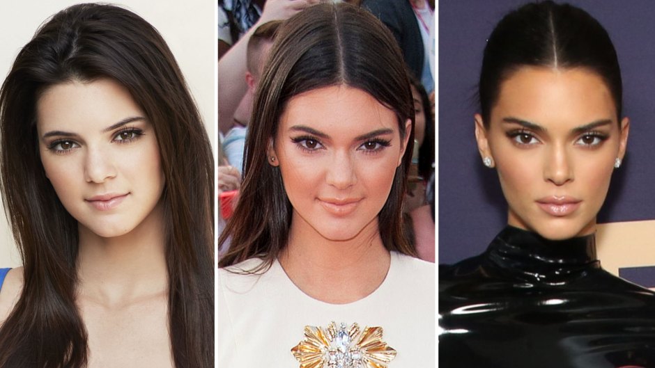Kendall Jenner before Plastic Surgery : Unveiling Her Youthful Transformation