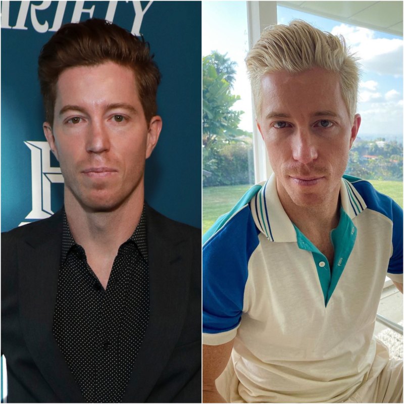 Shaun white hair transformation