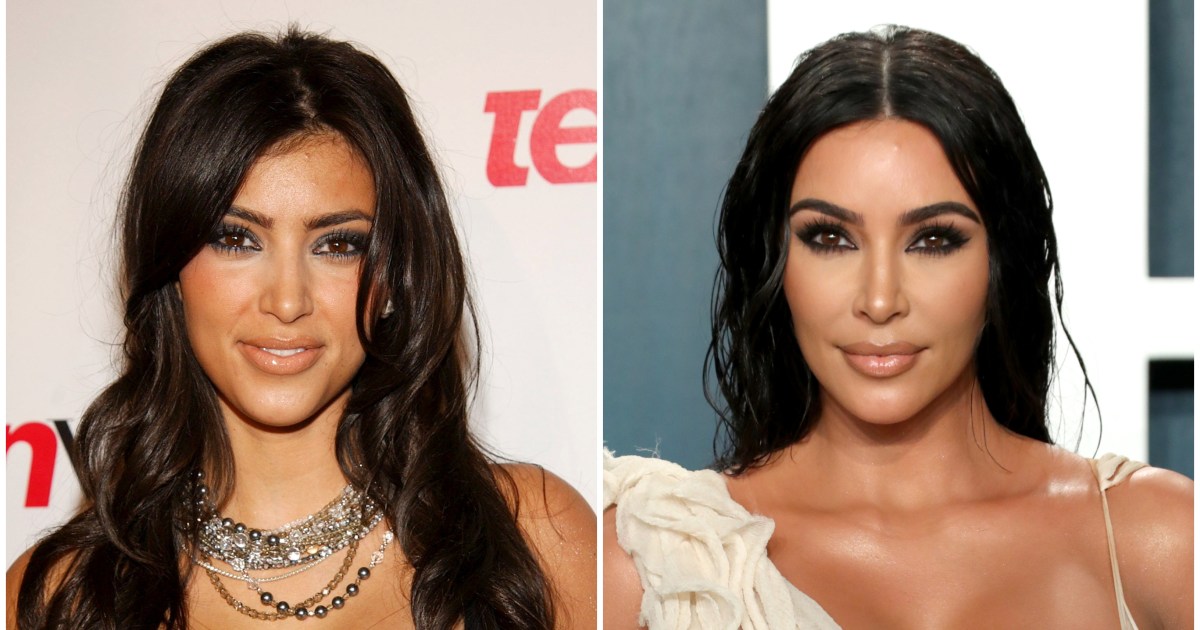 Kim Kardashian Before And After Plastic Surgery Timeline 1b2