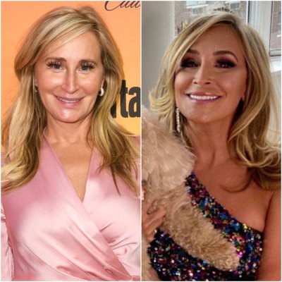Sonja Morgan Plastic Surgery Before and After Photo