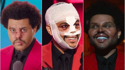 the-weeknd-plastic-surgery-face
