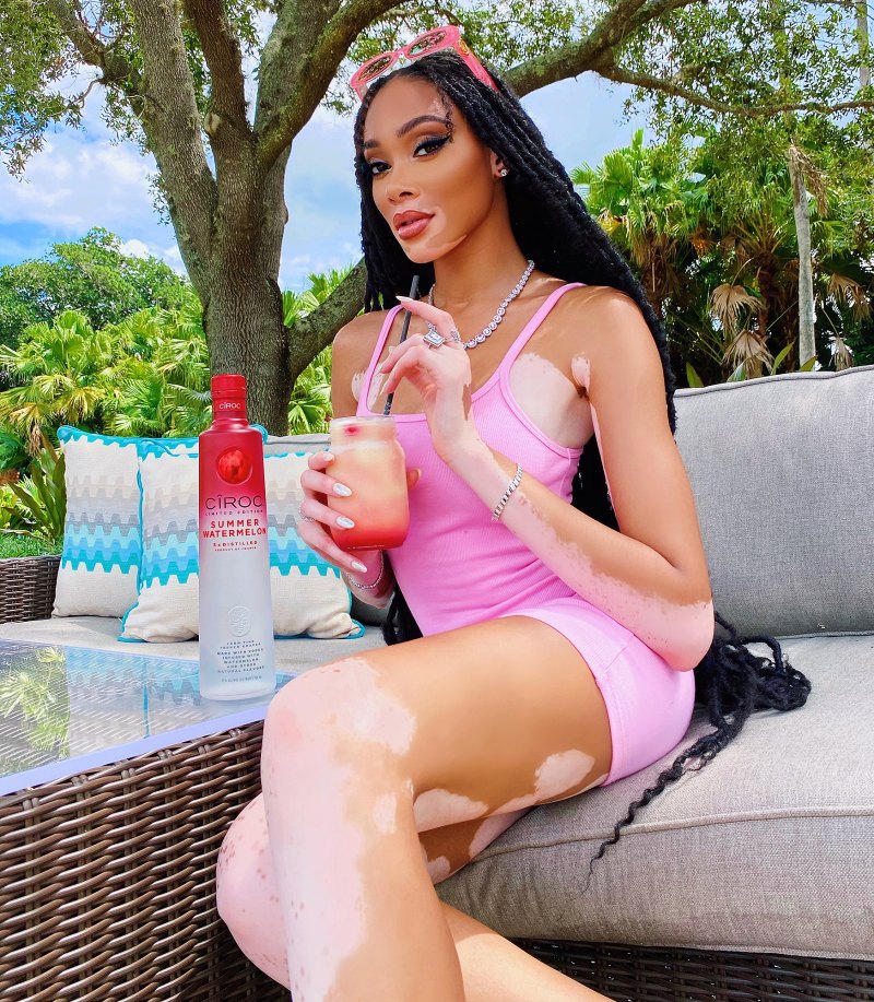 Winnie Harlow