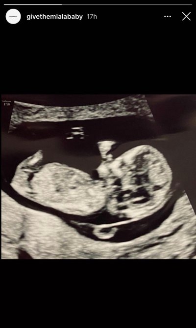 pregnant-vanderpump-rules-star-lala-kent-sonogram