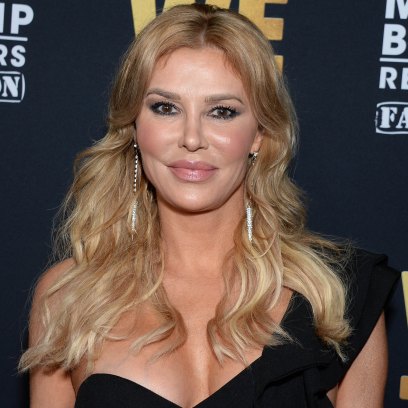 brandi-glanville-real-housewives-plastic-surgery