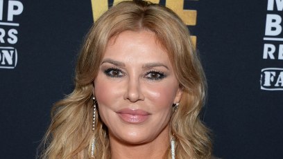 brandi-glanville-real-housewives-plastic-surgery