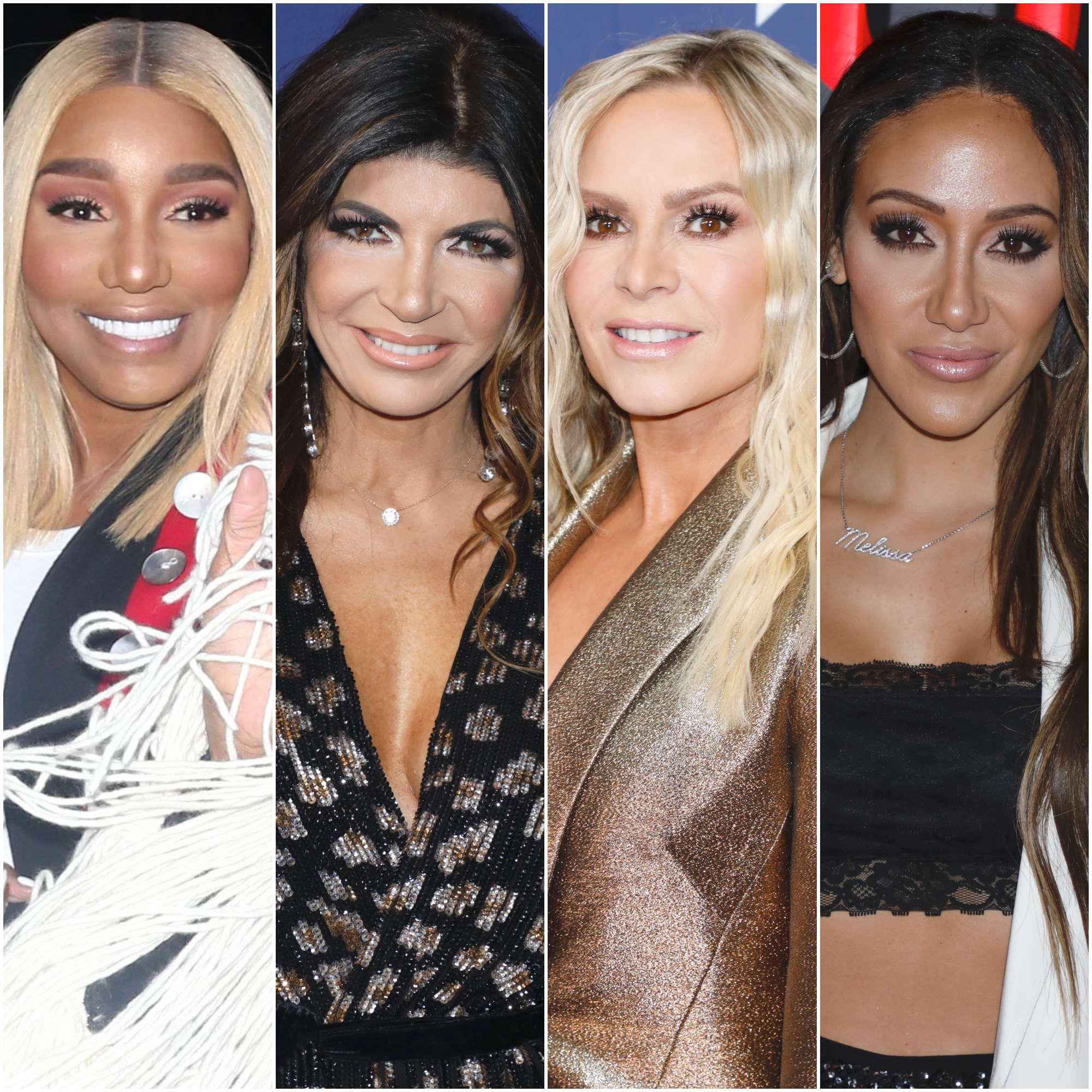 Real Housewives' Plastic Surgery: See Who Got Work Done