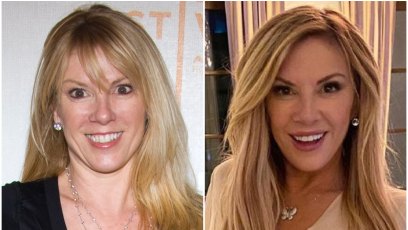 ramona-singer-plastic-surgery-transformation