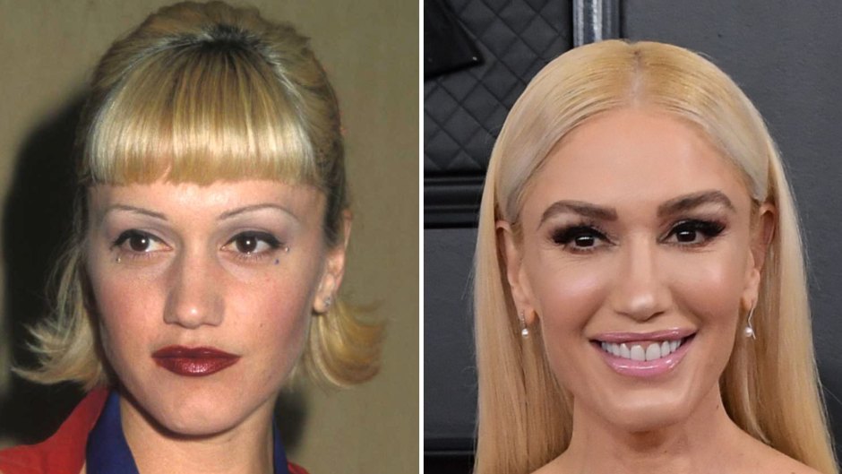 Ageless Beauty! Gwen Stefani's Transformation Over the Years