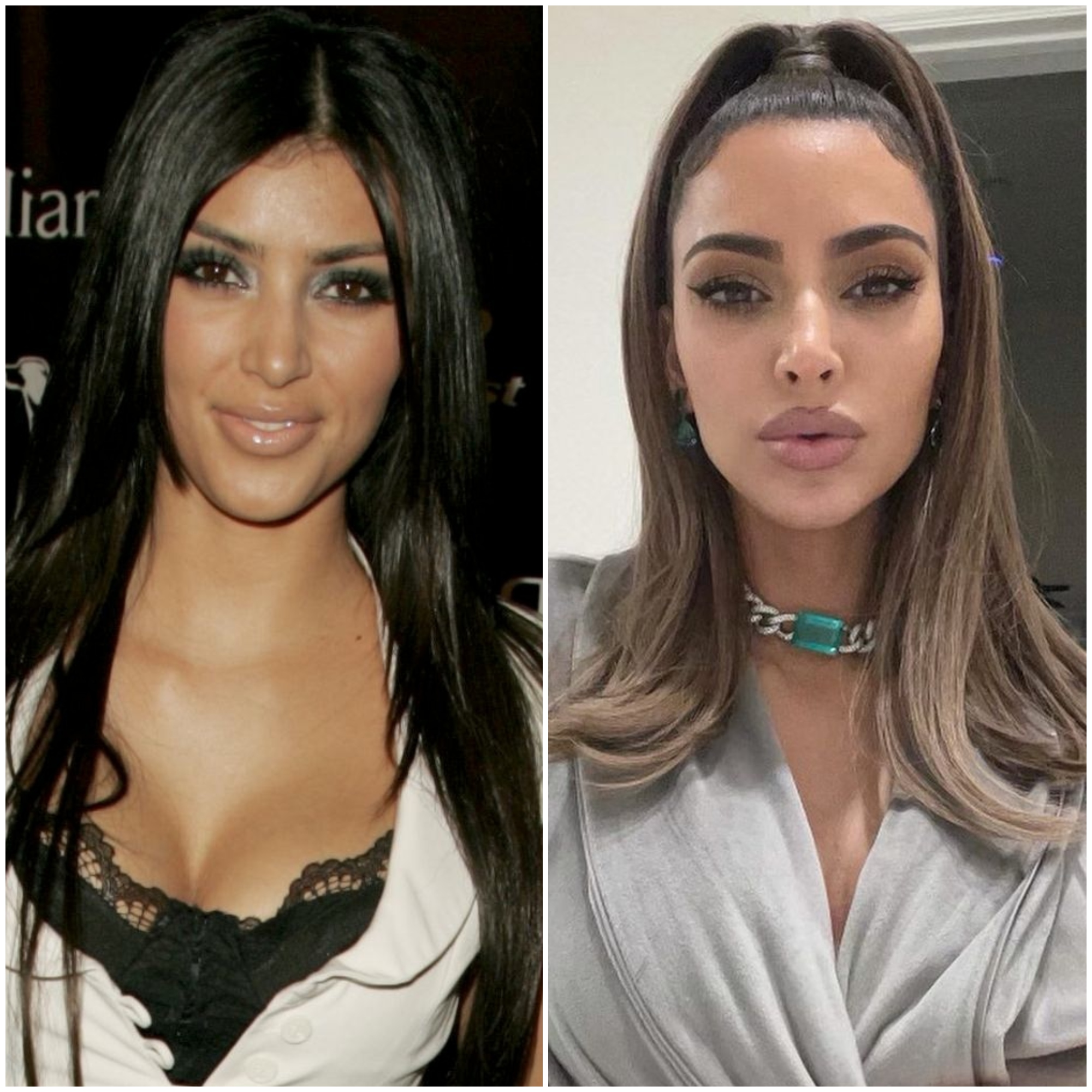 Collection 92+ Pictures Kim Kardashian Face Before And After Full HD ...