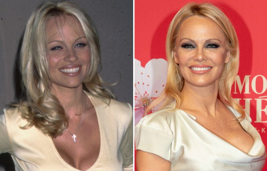 From 'Baywatch' to Today! See Pamela Anderson's Transformation Over the Years