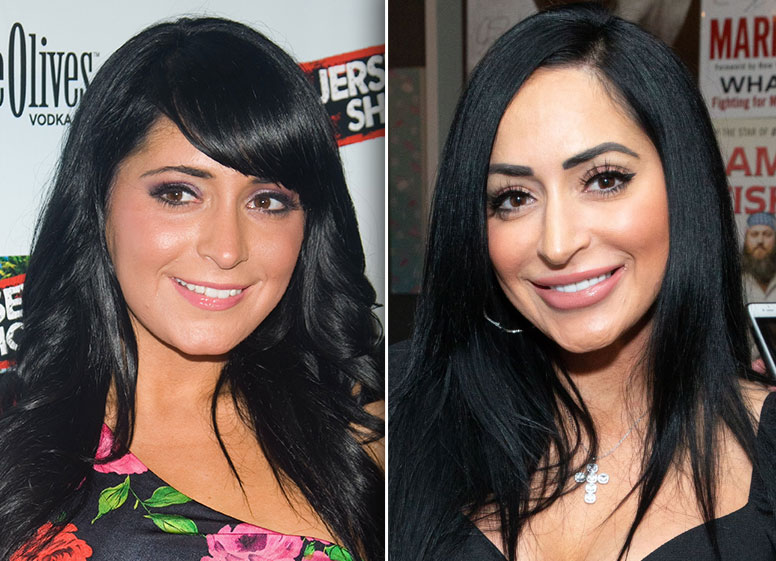 Jersey Shore' Stars Plastic Surgery Transformations: See Photos