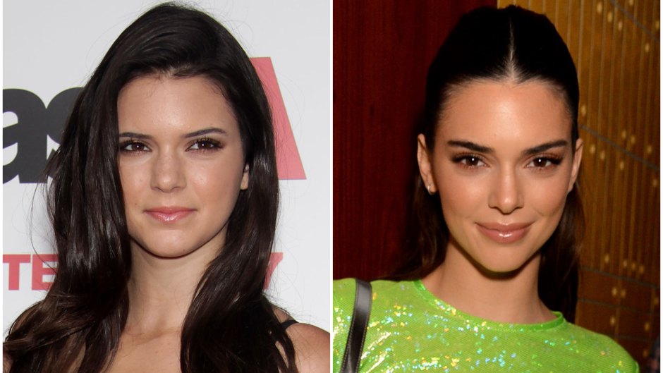 kendall-jenner-plastic-surgery-everything-she-said