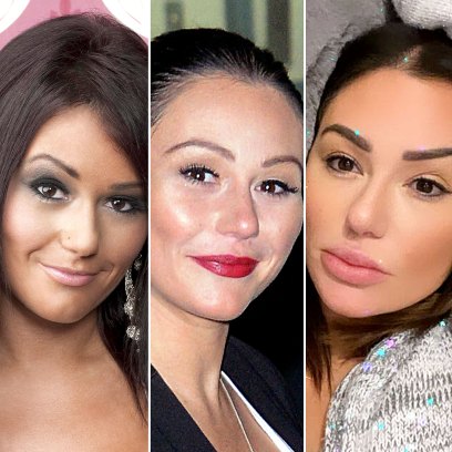 JWoww Plastic Surgery Transformation Before After