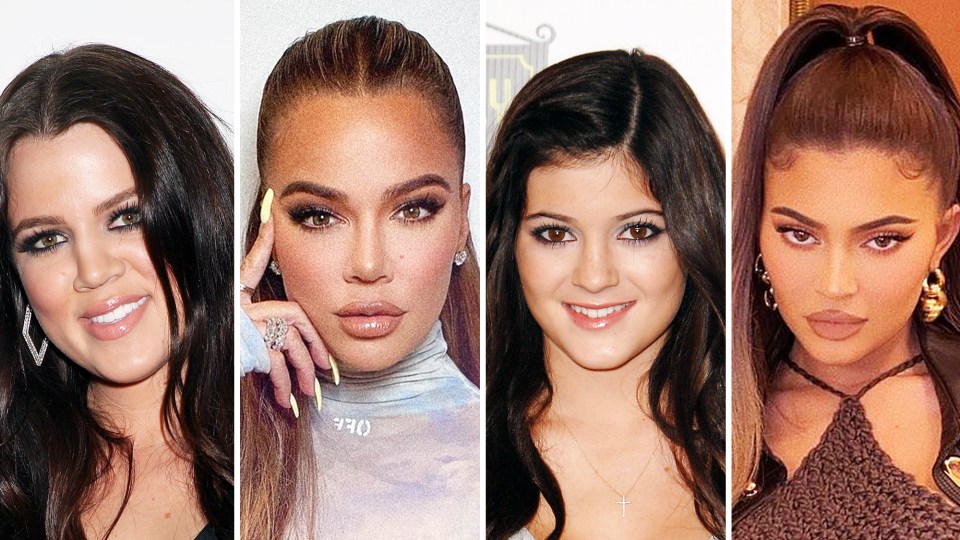 Kardashian-Jenners Plastic Surgery: Before and After Photos