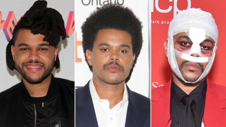 Starboy! The Weeknd's Total Transformation Over the Years