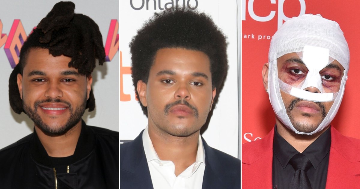 Did The Weeknd Get Plastic Medical Procedures? Transformation Images