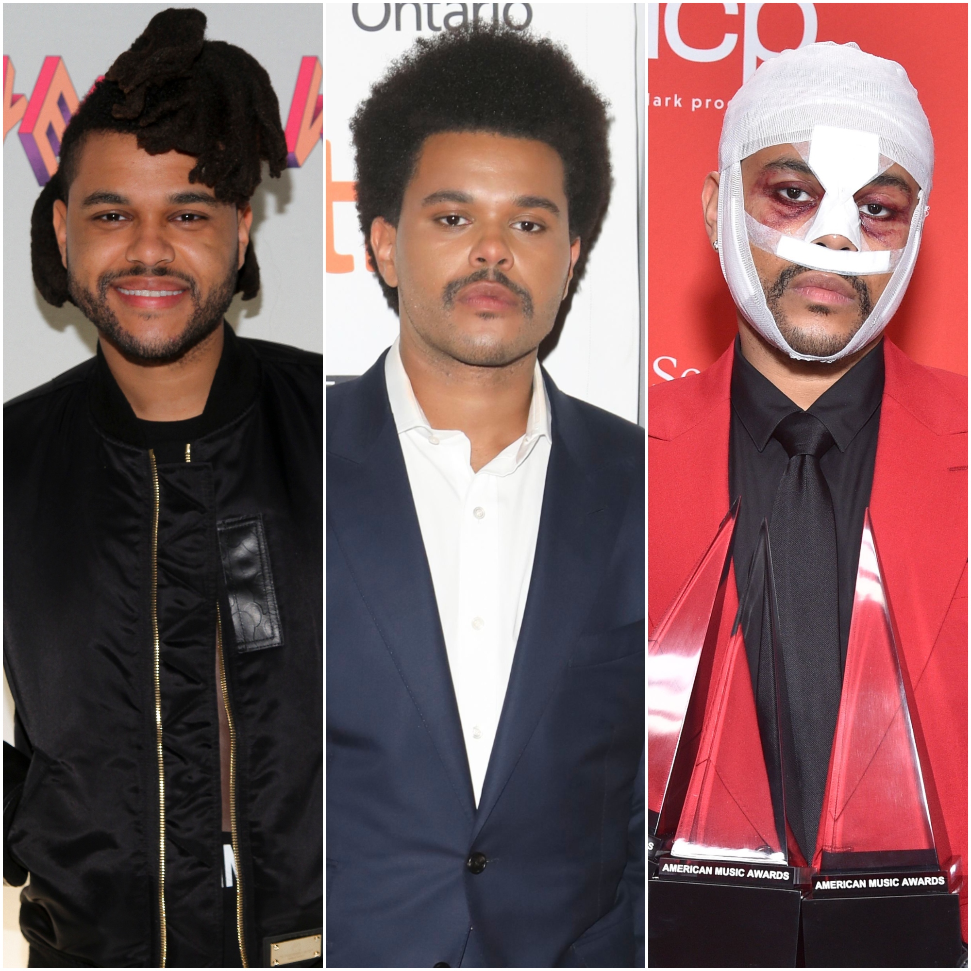 Did The Weeknd Get Plastic Surgery? Transformation Photos, the weekend ...