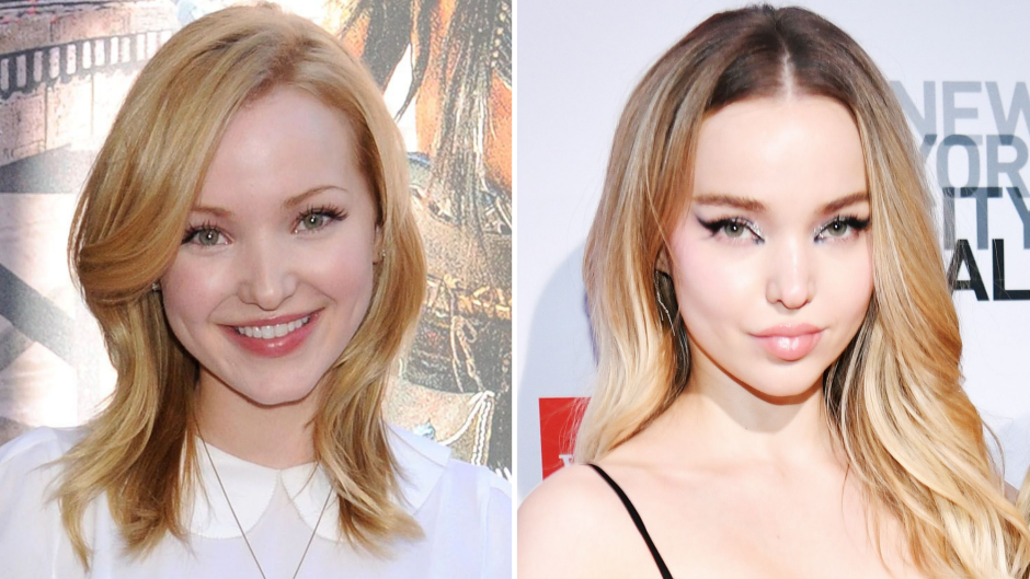From 'Shameless' to Today: Dove Cameron's Transformation Is Mind-Blowing!
