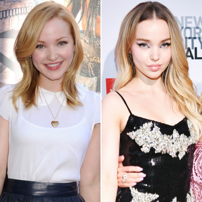 From 'Shameless' to Today: Dove Cameron's Transformation Is Mind-Blowing!