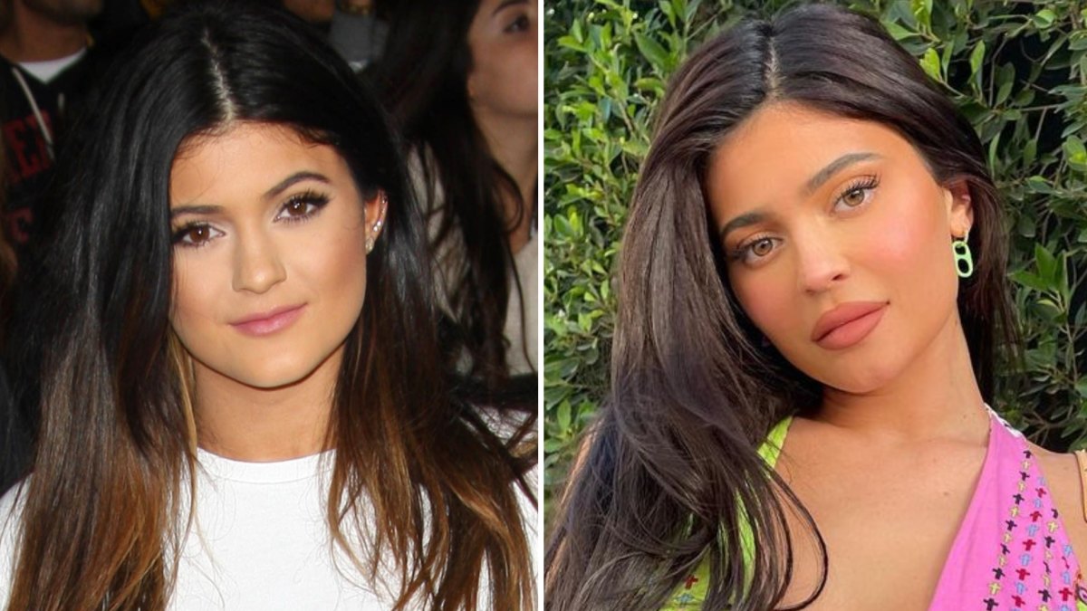 Kylie Jenner Transformation Photos: See How She'S Changed